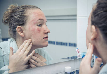 皮肤敏感如何“自救”？修复皮肤屏障是核心 